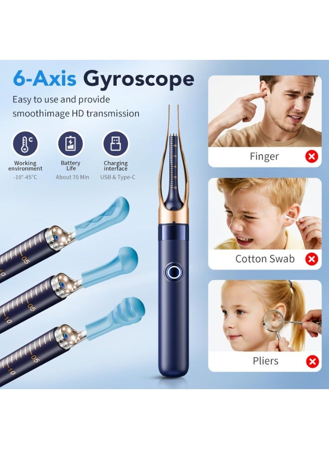 Ru syanl Smart Ear Wax Removal Kit with 1296P HD Camera, Wireless WiFi Ear Cleaner, Visual Otoscope with 6 LED Lights, Silicone Ear Pick Tool for Safe Ear Cleaning, Compatible with iPhone & Android - Image 5
