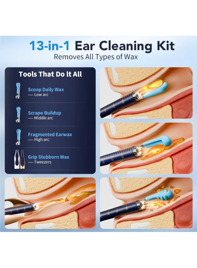 Ru syanl Smart Ear Wax Removal Kit with 1296P HD Camera, Wireless WiFi Ear Cleaner, Visual Otoscope with 6 LED Lights, Silicone Ear Pick Tool for Safe Ear Cleaning, Compatible with iPhone & Android - Image 2