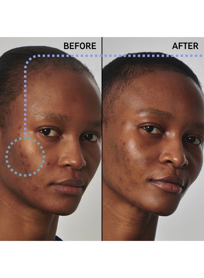 سيروم النياسيناميد بتركيز 20% من ذا إنكي ليست سوبر سوليوشنز - Image 3