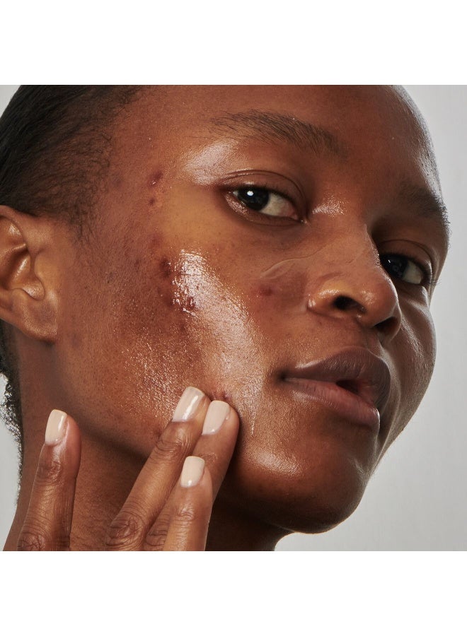 سيروم النياسيناميد بتركيز 20% من ذا إنكي ليست سوبر سوليوشنز - Image 4