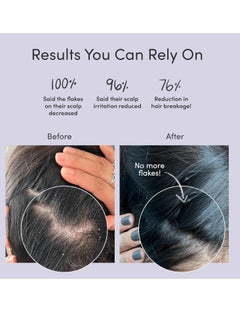JUPITER Jupiter Physician-Formulated Anti Dandruff Shampoo & Conditioner For Flaky, Itchy, Oily, Dry Scalp - Vegan, Sulfate Free - Color Safe & Paraben Free - Dry Scalp Shampoo and Conditioner For Women & Men  - Image 3