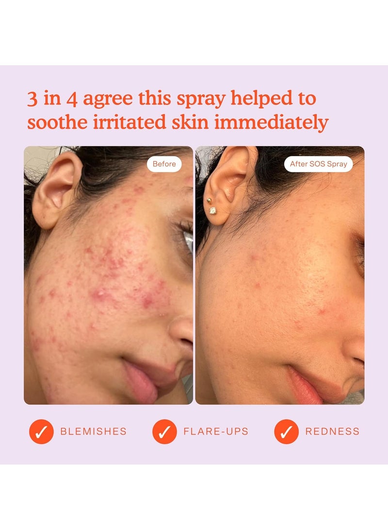 TOWER 28 SOS Daily Rescue Facial Spray for Sensitive Skin, Hypochlorous Acid Spray Helps Reduce Redness and Breakouts, Full Size Toner for Face, 4 FL Oz - Image 4