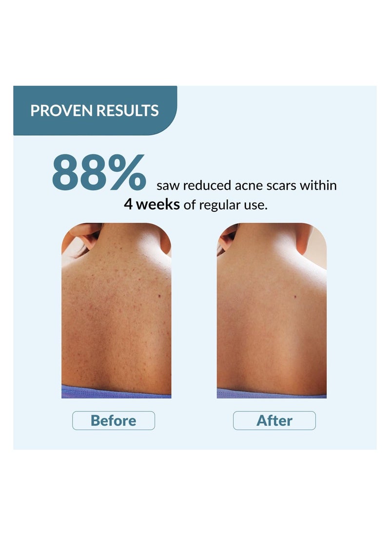 FIXDERMA FIXDERMA Salyzap Acne Body Wash 200ml  - Image 3