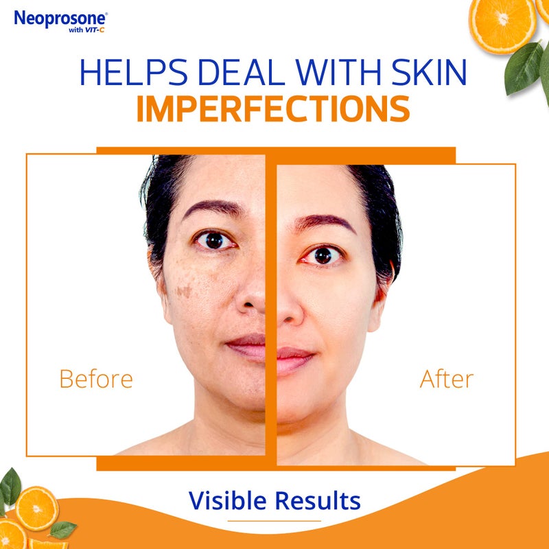 NEOPROSONE Vit C Dark Spot Corrector Gel Cream - 60 ml / 2 fl oz - Skin Brightening Gel to Remove Dark Spots and Restores Even Skin Tone - Anti Aging, Moisturizing Cream for Face, Elbows, Knees, Body - Image 4