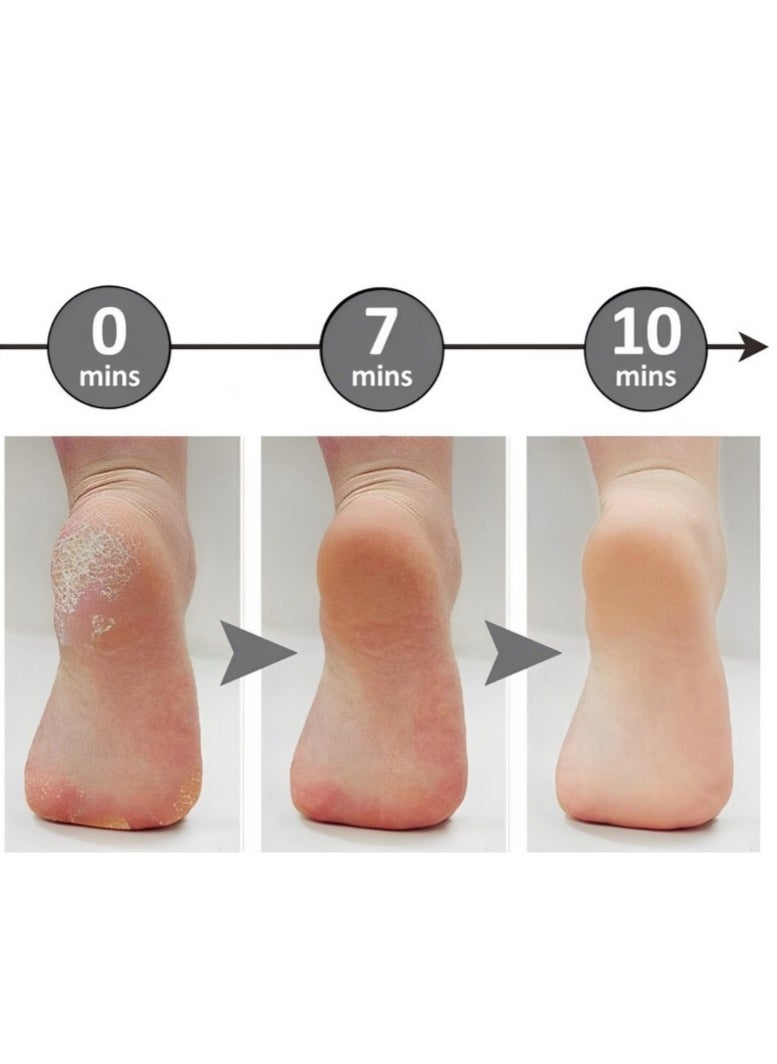 Generic Electric Foot Care File  Callous  Remover, Electronic Pedicure tool  - Image 3