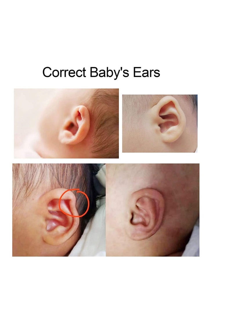 Y&D Baby Auricle Valgus Correction Patch Silicone Newborn Baby Ear Aesthetic Correctors Kids Infant Protruding Ear Patch Stickers for Newborn Infant Correction Health Care 4*50cm  - Image 4