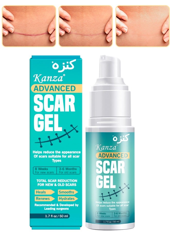 Kanza جل إزالة الندبات 50 مل جل الندبات المتقدم ينعم ويسطح الندبات الناتجة عن إصابات العمليات الجراحية والحروق علاج طبيعي للندبات للوجه والجسم - Image 1