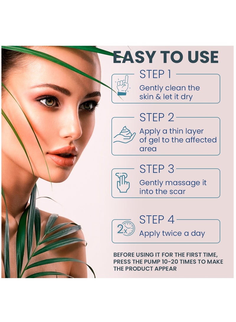 Kanza جل إزالة الندبات 50 مل جل الندبات المتقدم ينعم ويسطح الندبات الناتجة عن إصابات العمليات الجراحية والحروق علاج طبيعي للندبات للوجه والجسم - Image 5