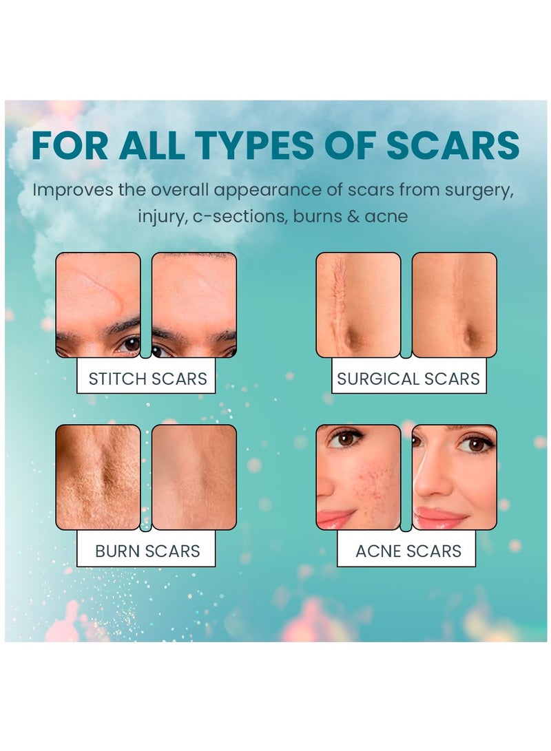 Kanza جل إزالة الندبات 50 مل جل الندبات المتقدم ينعم ويسطح الندبات الناتجة عن إصابات العمليات الجراحية والحروق علاج طبيعي للندبات للوجه والجسم - Image 4