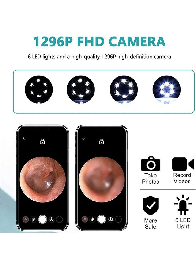 Arabest - WiFi Visible Wax Elimination Spoon，Wireless Ear Endoscope with LED Light - Image 1
