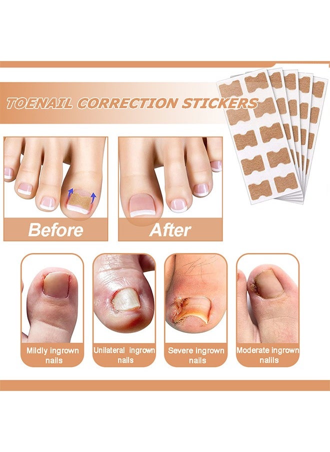 Flushy 120 Pcs Toenail Correction Patch, Ingrown Toenail Correction Sticker, Nail Treatment Corrector Sticker Pedicure Foot Care Tools (Color)  - Image 2