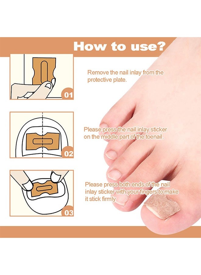 Flushy 120 Pcs Toenail Correction Patch, Ingrown Toenail Correction Sticker, Nail Treatment Corrector Sticker Pedicure Foot Care Tools (Color)  - Image 4