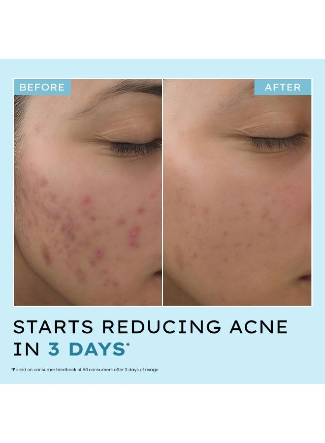 Hyphen Anti Acne 10% Azelaic Acid 2% Salicylic Acid Face Serum | 4% Niacinamide -Reduce Acne Marks, Fight Pimples | Tea Tree Extract -Soothes | Daily Serum for Women, Men | Oily, Acne Prone Skin -30ml - Image 4