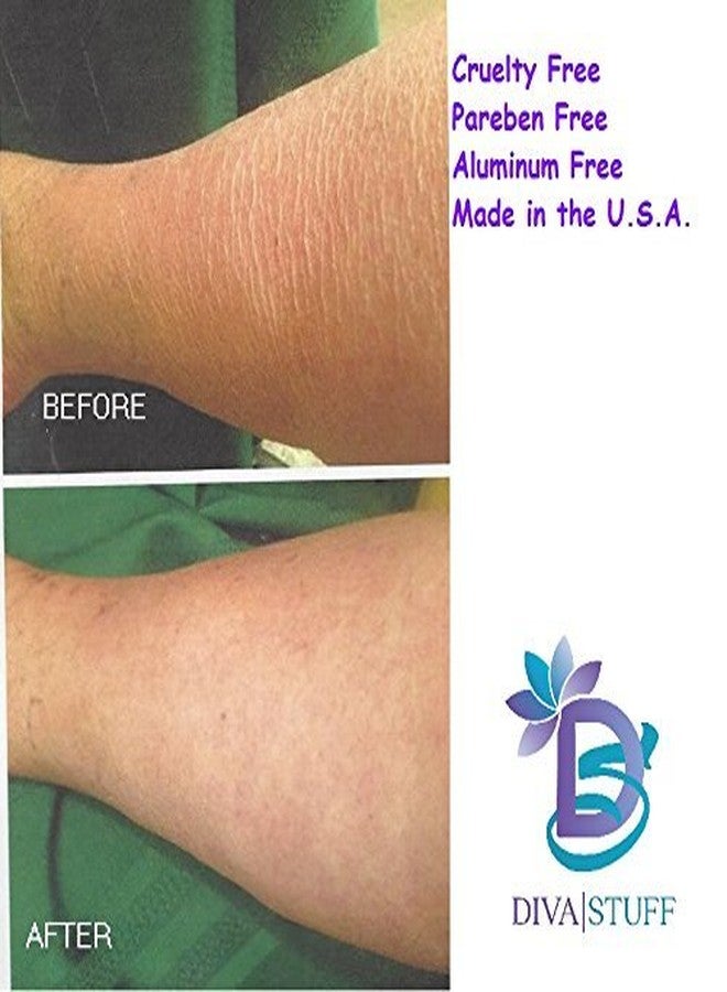 ديفا ستوف كريم ديفا ستاف إكستريم للبشرة المتجعدة للجسم والوجه مع حمض الهيالورونيك، وأحماض ألفا هيدروكسي، والمزيد (فانيليا) - Image 3