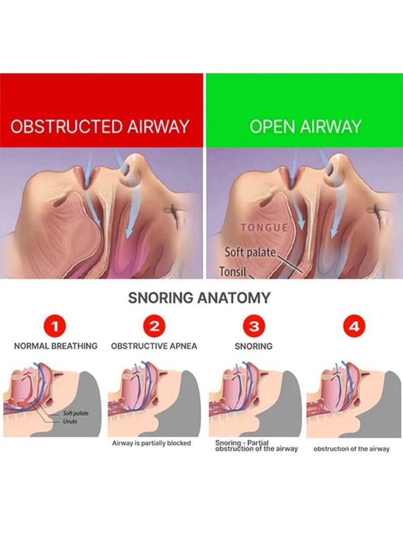 EELHOE قطعة الفم المضادة للشخير، جهاز مضاد للشخير، حل احترافي مريح قابل لإعادة الاستخدام، واقي فم مضاد للشخير قابل للتعديل، يحسن جودة النوم للجنسين - Image 5