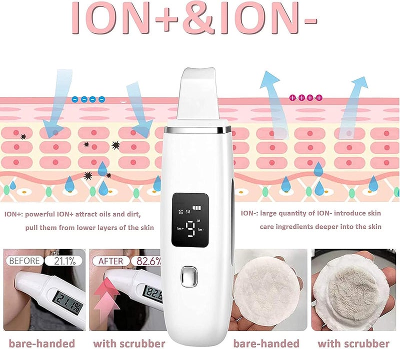Ultrasonic Skin Cleaner Skin Cleaning Device Remove Dirt and Blackheads - Image 5