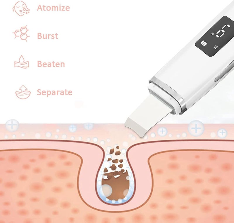 Ultrasonic Skin Cleaner Skin Cleaning Device Remove Dirt and Blackheads - Image 4