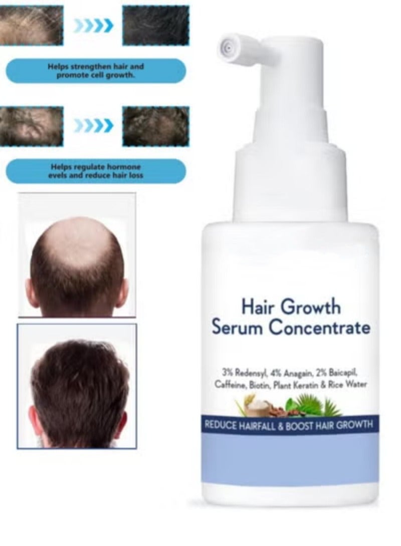 Hair Growth Botanical Renovation سيروم نمو الشعر المركز - 3% ريدنسيل، 4% أناغين، 2% بايكا بيل، كافيين، بيوتين، كيراتين نباتي وماء الأرز - سيروم نمو الشعر للرجال والنساء 30 مل - Image 1