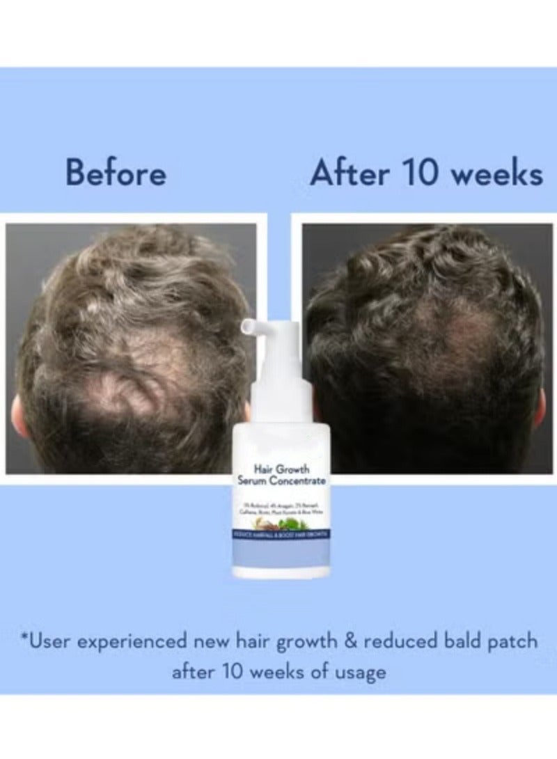 Hair Growth Botanical Renovation سيروم نمو الشعر المركز - 3% ريدنسيل، 4% أناغين، 2% بايكا بيل، كافيين، بيوتين، كيراتين نباتي وماء الأرز - سيروم نمو الشعر للرجال والنساء 30 مل - Image 2