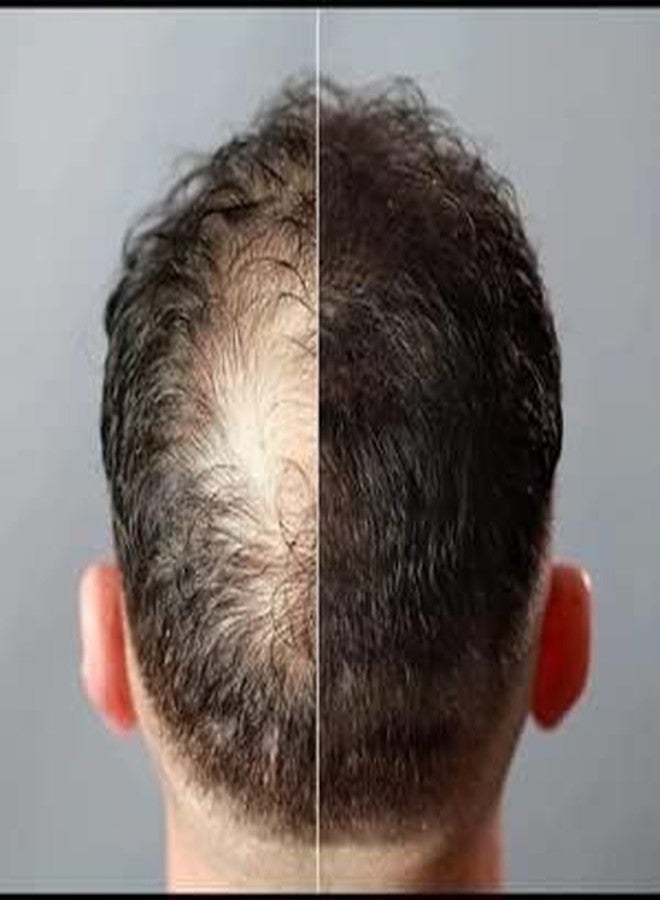 جوفينايل ألياف تكثيف الشعر من جوفينيل، أسود، 15 جم، بودرة تكثيف الشعر للشعر الخفيف والناعم، للرجال والنساء - Image 5