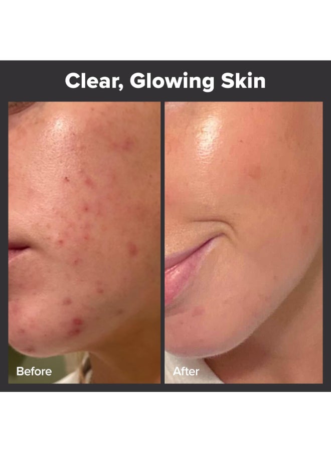 باولاز تشويس مقشر سائل 2% BHA 30 مل - Image 3