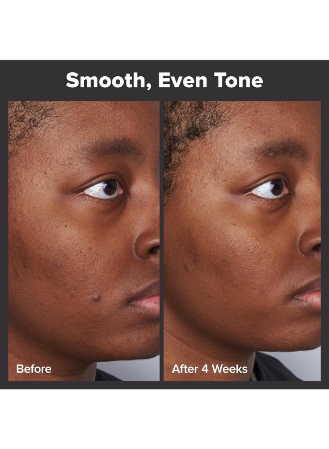 باولاز تشويس مقشر سائل 2% BHA 30 مل - Image 2