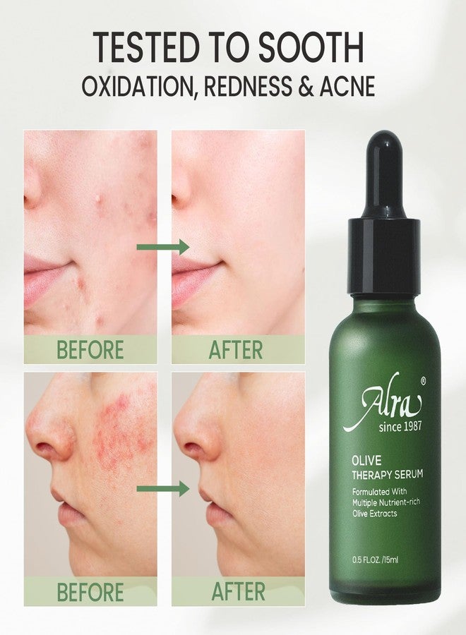 Alra Olive Therapy Serum for Face, Face Serum with 22% Olive Extracts, Reduces Redness & Acne, Rapidly Clear Breakout for Teens Adults, fit Oily & Acne-Prone Skin, 1 fl oz/30ml - Image 5