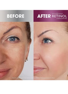 RETINOL Retinol Super Face Lift - Visibly firms and tightens for a lifted, younger look. Infused, with Vitamins C & E + Retinol Anti-Aging Day Cream Broad Spectrum SPF 20 Moisturizes & Reduces Fine Lines  - Image 2