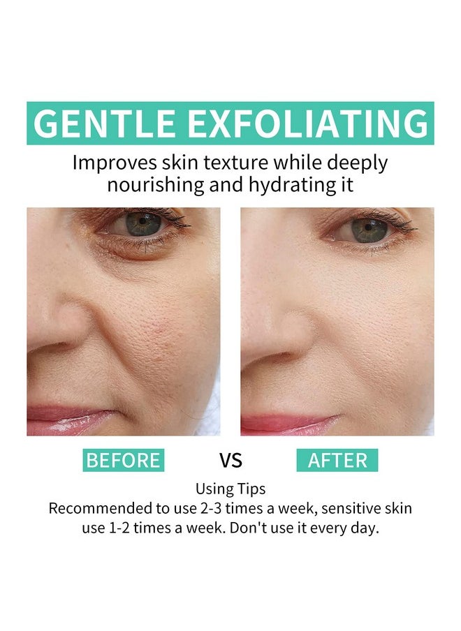 Tamoskiny - 35% Glycolic Acid Pads For Face & Body Exfoliating Facial Peel Aha Resurfacing Pads With Vitamins B5 C & E Green Tea Glycolic Acid Peel Pads For Dark Spots Acne Fine Lines & Wrinkles 50 Pads - Image 1