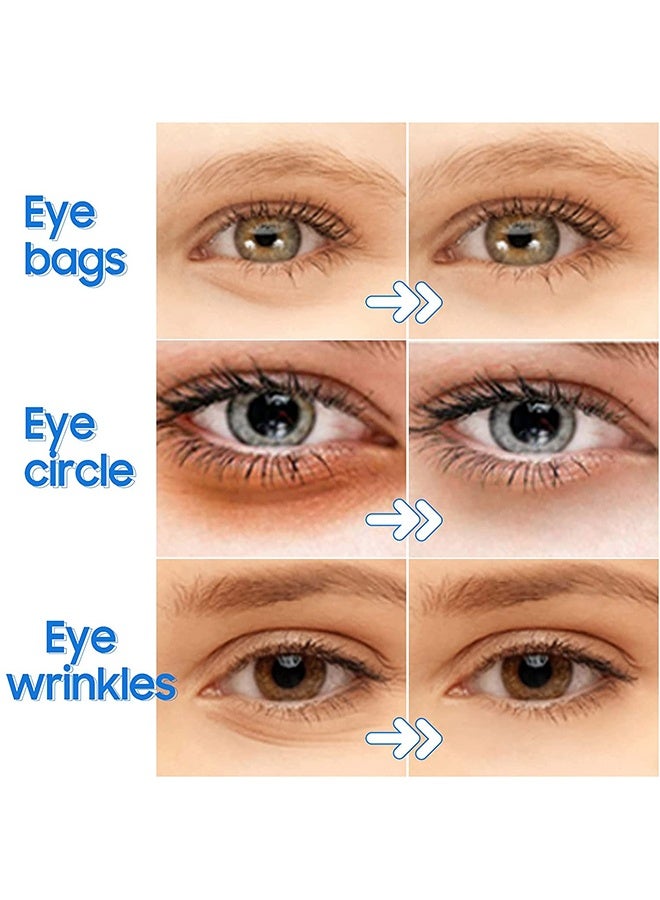 SADOER 10Pcs Under Eye Patches Blueberry Collagen Eye Mask Eye Gel Treatment Masks For Reducing Dark Circles, Puffy Eyes And Anti Aging, Under Eye Gel Pads Blueberry - Image 5