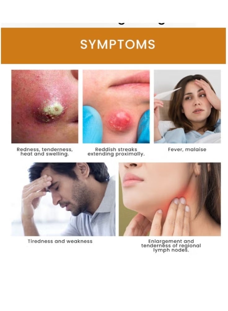 سوميفون كريم تخفيف الغليان يقلل الحرارة والتورم ويخفف التضخم والألم 20 جرام - Image 5