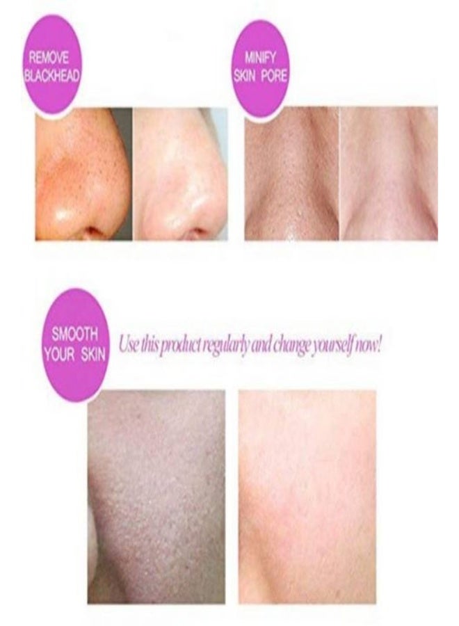 Ultrasonic Skin Scrubber For Blackhead Face Lifting White - Image 2