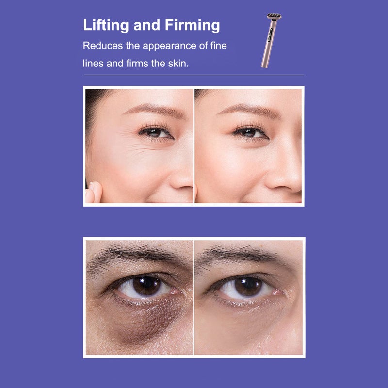 LED Light Therapy Eye Equipment for Skin Care at Home - Image 5