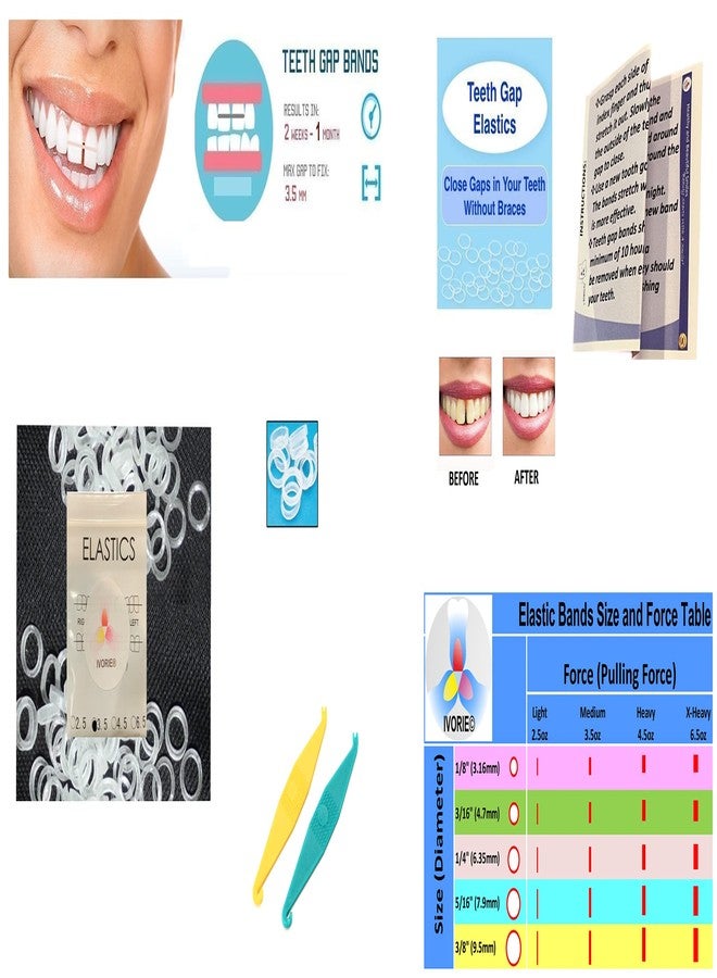 IVORIE Cosmetic Dental Lab Elastic Rubber Bands Braces Teeth Lab Gap Alignment 60pcs (5/16" Penguin 6.5oz (X-Heavy)) - Image 2