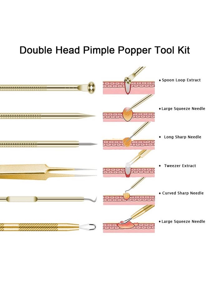 BLAAROOM - Pimple Popper Tool Kit 6 Pcs Blackhead Remover Acne Needle Tools Set Removing Treatment Comedone Whitehead Popping Zit For Nose Face Skin Blemish Extractor Tool Gold - Image 1