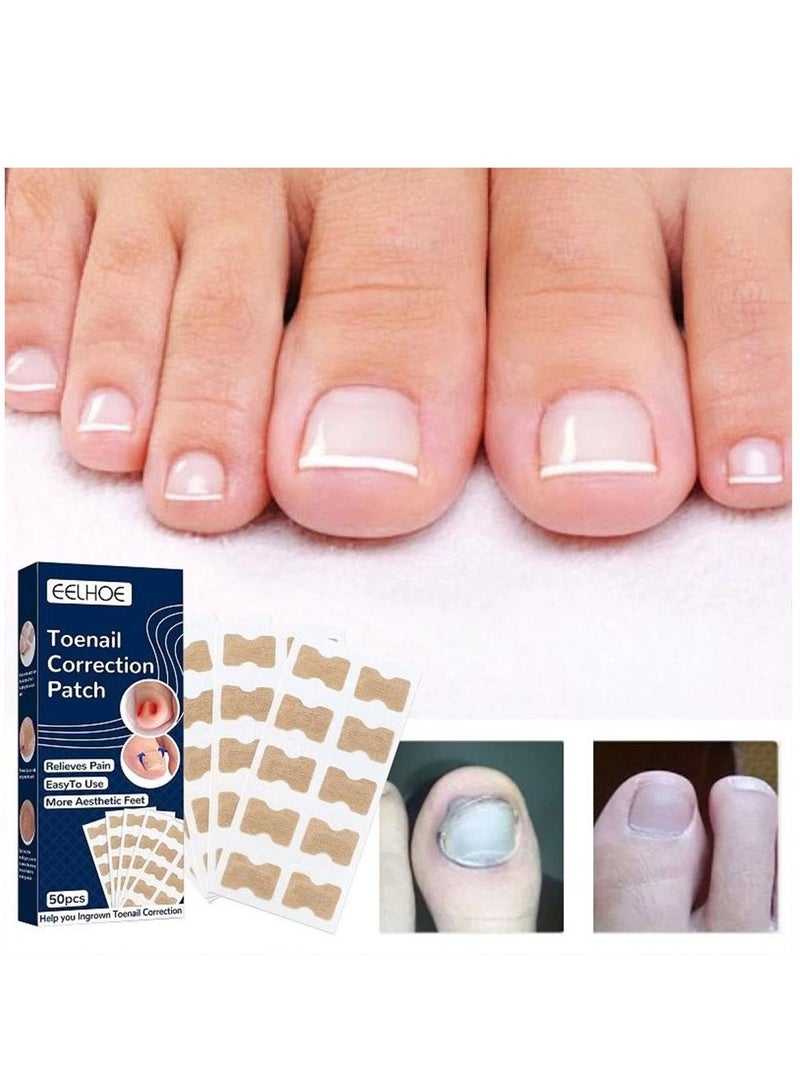 EELHOE 50 Pieces Toenail Correction Stickers Ingrown Toenail Corrector Strips Elastic Curved Toenails Brace Stickers - Image 2