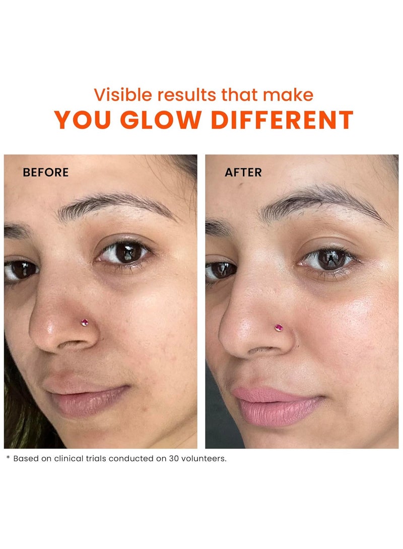 foxtale THE STUNNER SKIN RADIANCE MASk - Image 5