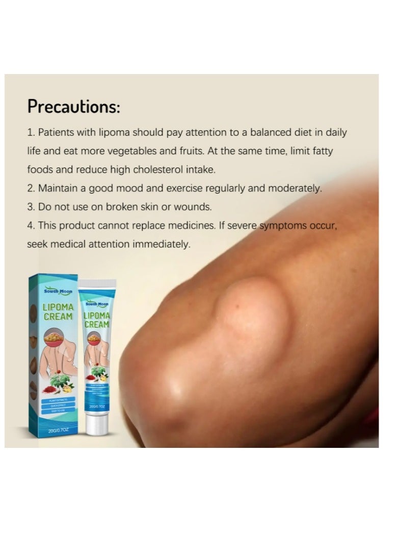 SOUTH MOON - Lipoma Removal Cream 20g, Lipoma Removal Cream Ointment, Lipoma Elimination Cream, Get Rid of Your Fatty Lipoma Lumps - Image 1