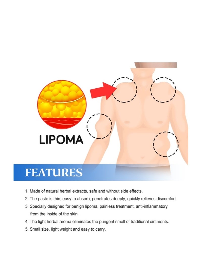 SOUTH MOON - Lipoma Removal Cream 20g, Lipoma Removal Cream Ointment, Lipoma Elimination Cream, Get Rid of Your Fatty Lipoma Lumps - Image 1