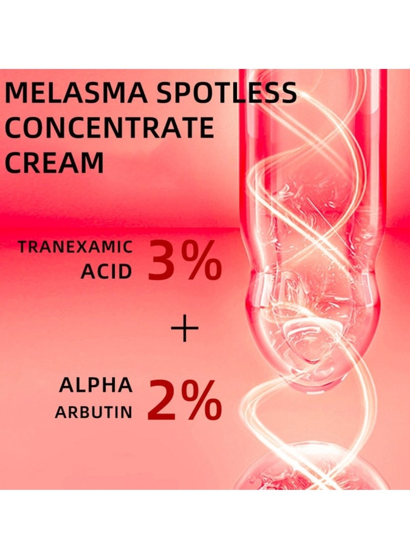 Melasma Spotless Concentrate Cream Dark Spot Cream for Face Reduce Dark Circles and Fine Lines Moisturizing Hydrating and Firming Cream Melasma Treatment Age Spots Freckle Remover Cream 15G