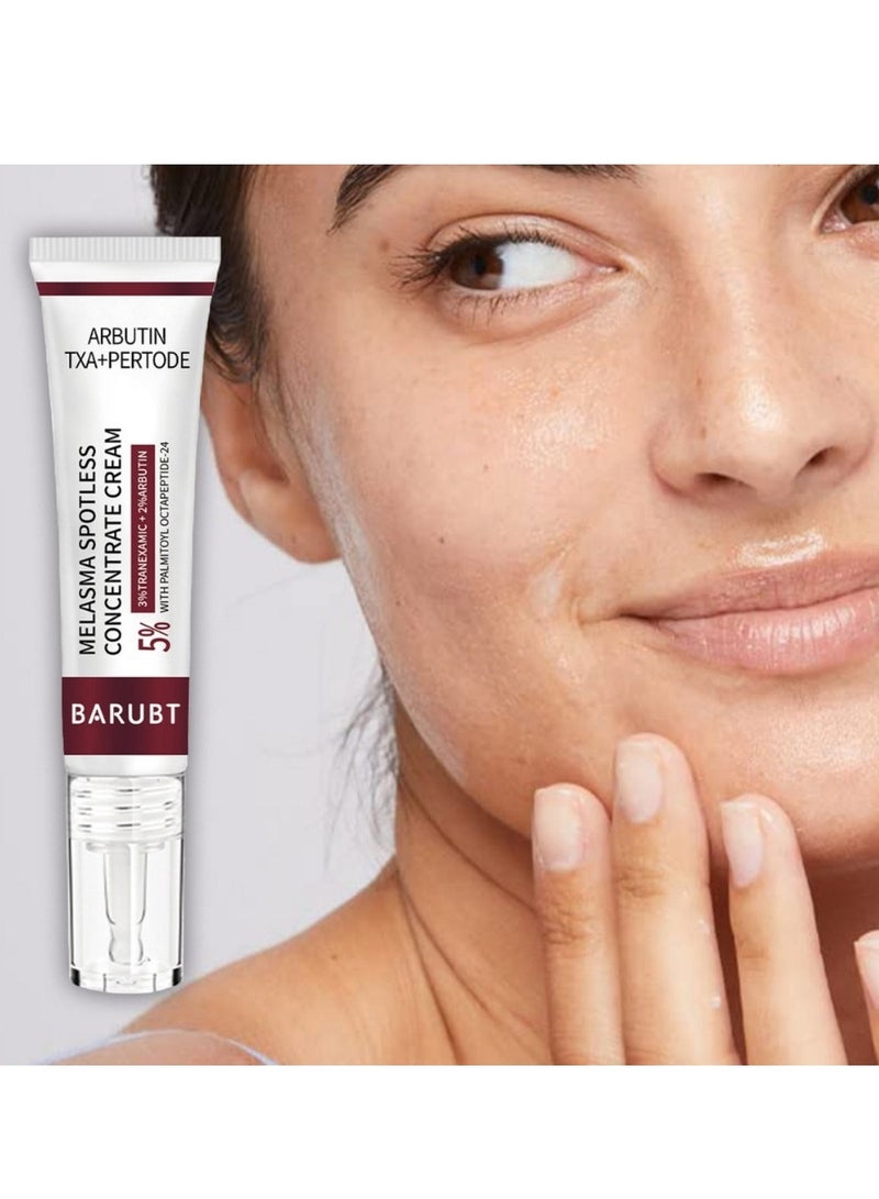 Melasma Spotless Concentrate Cream Dark Spot Cream for Face Reduce Dark Circles and Fine Lines Moisturizing Hydrating and Firming Cream Melasma Treatment Age Spots Freckle Remover Cream 15G