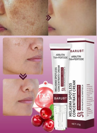 Melasma Spotless Concentrate Cream Dark Spot Cream for Face Reduce Dark Circles and Fine Lines Moisturizing Hydrating and Firming Cream Melasma Treatment Age Spots Freckle Remover Cream 15G - pzsku/ZBD18A01F3072B85AE156Z/45/_/1737465410/3c498dc9-ffb2-4935-a13b-82c4eccd5c48