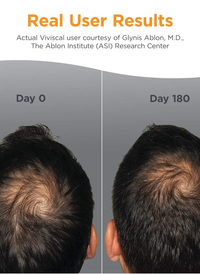Viviscal - Men's Hair Growth Supplements 180 Tablets - 3 Month Supply - Image 1