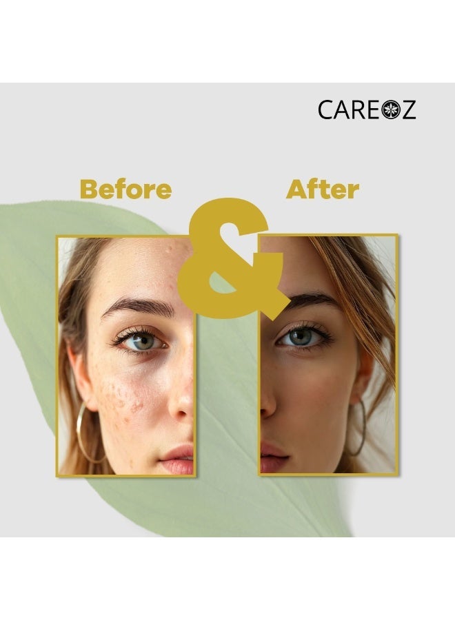 CAREOZ Aloe Vera, Amla & Lemon Peel Detox & Glow All-Over Mask - Image 2