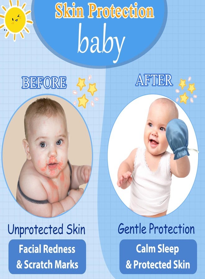 Heyshapeing 1 Pair Satin Eczema Gloves for Babies Kids Eczema Mittens Anti Scratch Eczema Relief Hand Gloves Adjustable (Blue) - Image 4
