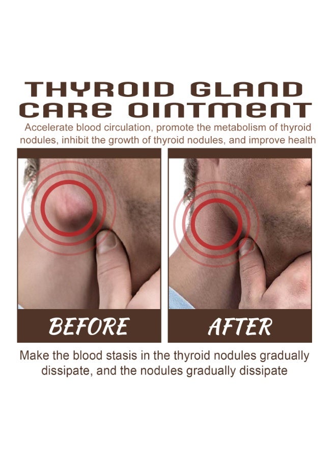 ساوث مون العناية بالغدة الدرقية، تقلل من تورم الرقبة وتخفف من التهاب الغدد الليمفاوية - Image 3
