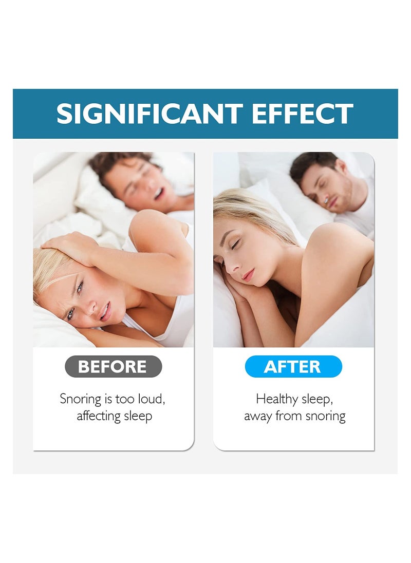 SYOSI Snore Stopper Clipple Anti Snoring Device Silicone Nose Clip Magnetic Nasal Dilator Provide The Effective Solution to Stop 5PCS  - Image 2