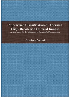 Supervised Classification of Thermal High-Resolution Infrared Images: A case study for the diagnosis of Raynaud's Phenomenon  - Image 2
