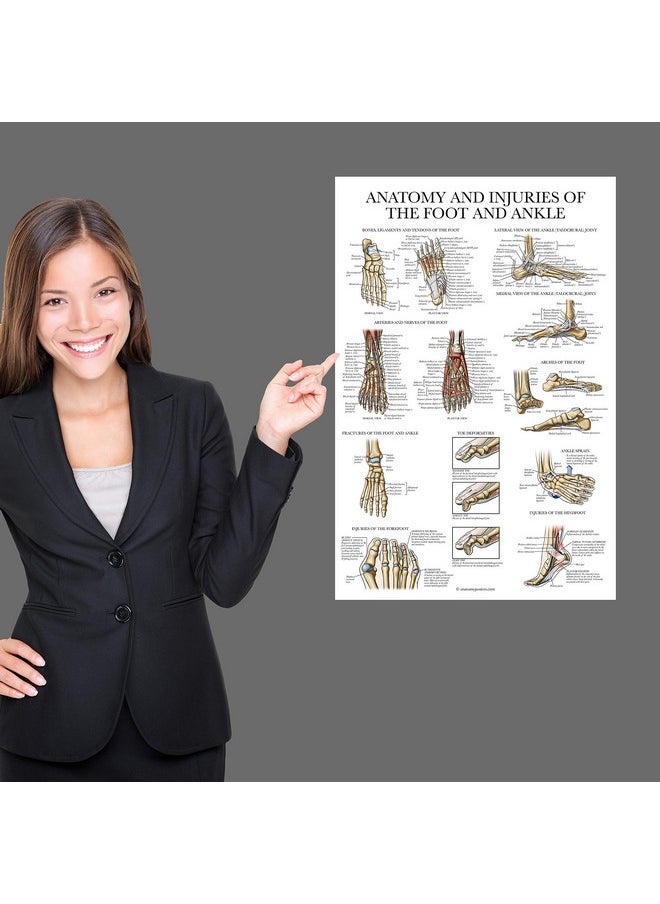 Palace Learning Palace Learning Laminated Anatomy and Injuries of the Foot and Ankle Poster - Anatomical Chart of Foot and Ankle Joint - 18" x 24"  - Image 4