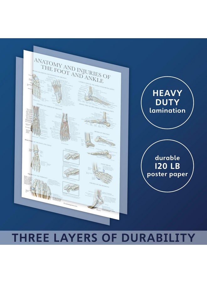 Palace Learning Palace Learning Laminated Anatomy and Injuries of the Foot and Ankle Poster - Anatomical Chart of Foot and Ankle Joint - 18" x 24"  - Image 3